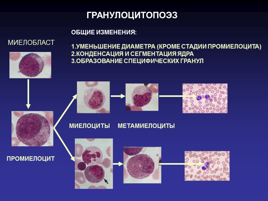 ГРАНУЛОЦИТОПОЭЗ МИЕЛОБЛАСТ ПРОМИЕЛОЦИТ МИЕЛОЦИТЫ МЕТАМИЕЛОЦИТЫ ОБЩИЕ ИЗМЕНЕНИЯ: 1.УМЕНЬШЕНИЕ ДИАМЕТРА (КРОМЕ СТАДИИ ПРОМИЕЛОЦИТА) 2.КОНДЕНСАЦИЯ И